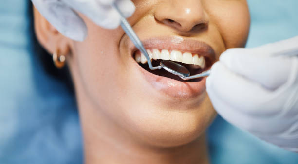 Best Same-Day Emergency Dental Services in Warner Robins, GA