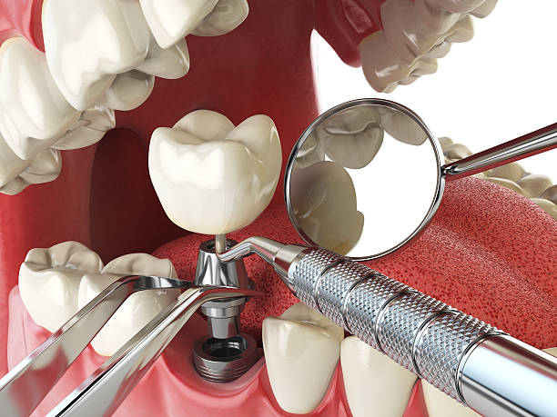 Best Same-Day Emergency Dental Services in Warner Robins, GA